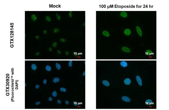 ATR (phospho Thr1989) antibody detects ATR (phospho Thr1989) protein at nucleus by immunofluorescent analysis. Sample: Mock and treated HeLa cells were fixed in 4% paraformaldehyde at RT for 15 min. Green: ATR (phospho Thr1989) stained by ATR (phospho Thr1989) antibody (GTX128145) diluted at 1:500. Blue: Fluoroshield with DAPI (GTX30920).