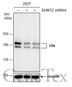 Non-transfected (–) and transfected (+) 293T whole cell extracts (30 μg) were separated by 5% SDS-PAGE, and the membrane was blotted with G9a antibody (GTX128164) diluted at 1:1000. The HRP-conjugated anti-rabbit IgG antibody (GTX213110-01) was used to detect the primary antibody.