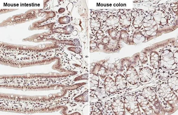 G9a antibody detects G9a protein at nucleus by immunohistochemical analysis. Sample: Paraffin-embedded mouse tissue. G9a stained by G9a antibody (GTX128164) diluted at 1:500. Antigen Retrieval: Citrate buffer, pH 6.0, 15 min