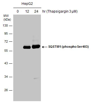 HepG2 cells were untreated or treated with 3μM thapsigargin for 12 and 24 hrs. Whole cell extracts (30 μg) were separated by 10% SDS-PAGE, and the membrane was blotted with SQSTM1 (phospho Ser403) antibody (GTX128171) diluted at 1:500. The HRP-conjugated anti-rabbit IgG antibody (GTX213110-01) was used to detect the primary antibody.