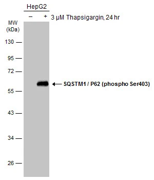 Anti-SQSTM1 / P62 (phospho Ser403) antibody (GTX128171