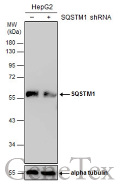 Non-transfected (–) and transfected (+) HepG2 whole cell extracts (30 μg) were separated by 10% SDS-PAGE, and the membrane was blotted with SQSTM1 antibody (GTX128173) diluted at 1:1000.