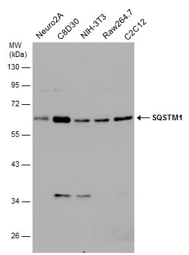 Various whole cell extracts (30 μg) were separated by 10% SDS-PAGE, and the membrane was blotted with SQSTM1 antibody (GTX128173) diluted at 1:1000.