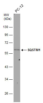 Whole cell extract (30 μg) was separated by 10% SDS-PAGE, and the membrane was blotted with SQSTM1 antibody (GTX128173) diluted at 1:1000.