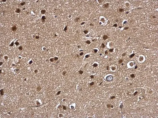 Myt1 antibody detects Myt1 protein at nucleus on mouse skin by immunohistochemical analysis. Sample: Paraffin-embedded mouse middle brain. Myt1 antibody (GTX128188) dilution: 1:500.
