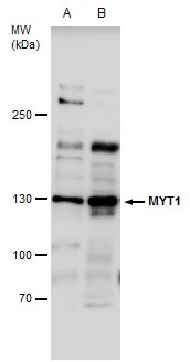 Myt1 antibody detects Myt1 protein by western blot analysis. A. 30 μg IMR32 whole cell extract B. 30 μg IMR32 nuclear extract 5 % SDS-PAGE Myt1 antibody (GTX128188) dilution: 1:500