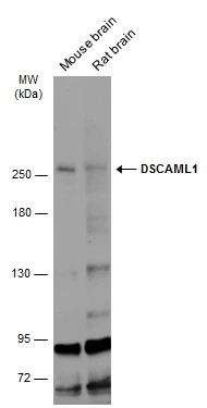 Various tissue extracts (50 μg) were separated by 5% SDS-PAGE, and the membrane was blotted with DSCAML1 antibody (GTX128231) diluted at 1:500. The HRP-conjugated anti-rabbit IgG antibody (GTX213110-01) was used to detect the primary antibody. Various tissue extracts (50 μg) were separated by 5% SDS-PAGE, and the membrane was blotted with DSCAML1 antibody (GTX128231) diluted at 1:500. The HRP-conjugated anti-rabbit IgG antibody (GTX213110-01) was used to detect the primary antibody.
