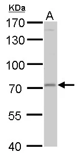 MMP24 antibody detects MMP24 protein by Western blot analysis. A. 50 μg mouse brain lysate/extract 7.5 % SDS-PAGE MMP24 antibody (GTX128246) dilution: 1:1000
