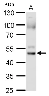 Foxa2 antibody detects foxa2 protein by western blot analysis. A. 60 ug zebrafish 10 hpf (hours post fertilization) lysate/extract 10 % SDS-PAGE Foxa2 antibody (GTX128273) dilution: 1:500