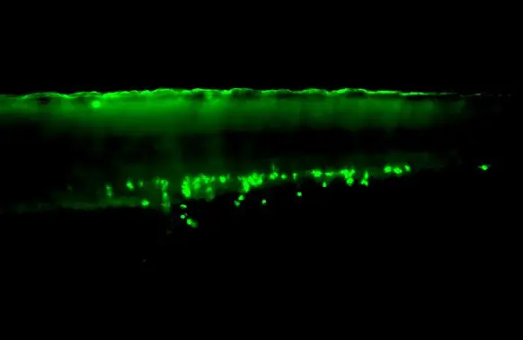 CYHMページ Anti-Mpx antibody (GTX128379) | GeneTex