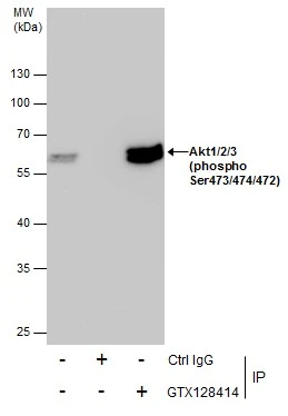 Immunoprecipitation of Akt1/2/3 (phospho Ser473/474/472) protein from 293T whole cell extracts using 5 ug of Akt1/2/3 (phospho Ser473/474/472) antibody (GTX128414).