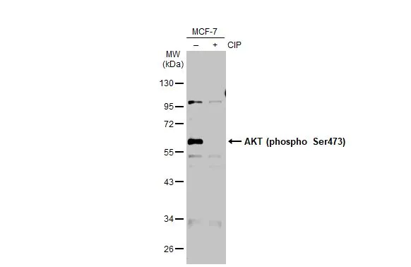「watpho197　様」　専用 Anti-AKT (phospho Ser473) antibody (GTX128414) | GeneTex