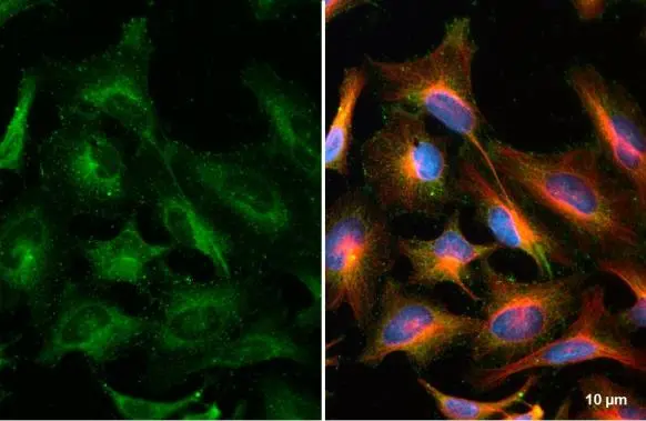 ATG9A antibody detects ATG9A protein at cytoplasm by immunofluorescent analysis. Sample: HeLa cells were fixed in ice-cold MeOH for 5 min. Green: ATG9A stained by ATG9A antibody (GTX128427) diluted at 1:500. Red: alpha Tubulin, a cytoskeleton marker, stained by alpha Tubulin antibody [GT114] (GTX628802) diluted at 1:1000. Blue: Fluoroshield with DAPI (GTX30920).