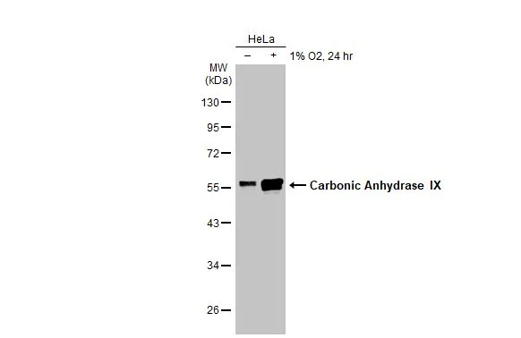 Untreated (–) and treated (+) HeLa whole cell extracts (30 μg) were separated by 10% SDS-PAGE, and the membrane was blotted with Carbonic Anhydrase IX antibody (GTX128428) diluted at 1:1000. The HRP-conjugated anti-rabbit IgG antibody (GTX213110-01) was used to detect the primary antibody. Untreated (–) and treated (+) HeLa whole cell extracts (30 μg) were separated by 10% SDS-PAGE, and the membrane was blotted with Carbonic Anhydrase IX antibody (GTX128428) diluted at 1:1000. The HRP-conjugated anti-rabbit IgG antibody (GTX213110-01) was used to detect the primary antibody.