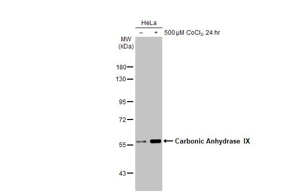 Anti-Carbonic Anhydrase IX antibody (GTX128428) | GeneTex