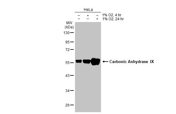 Untreated (–) and treated (+) HeLa whole cell extracts (30 μg) were separated by 10% SDS-PAGE, and the membrane was blotted with Carbonic Anhydrase IX antibody (GTX128428) diluted at 1:1000. The HRP-conjugated anti-rabbit IgG antibody (GTX213110-01) was used to detect the primary antibody. Untreated (–) and treated (+) HeLa whole cell extracts (30 μg) were separated by 10% SDS-PAGE, and the membrane was blotted with Carbonic Anhydrase IX antibody (GTX128428) diluted at 1:1000. The HRP-conjugated anti-rabbit IgG antibody (GTX213110-01) was used to detect the primary antibody.
