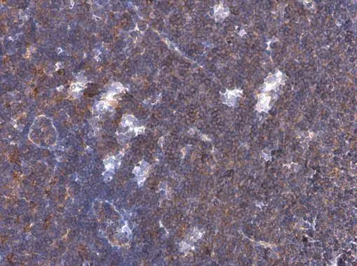 PD1 antibody detects PD1 protein at cell membrane by immunohistochemical analysis. Sample: Paraffin-embedded mouse lymph node. PD1 stained by PD1 antibody (GTX128435) diluted at 1:500.
 Antigen Retrieval: Citrate buffer, pH 6.0, 15 min