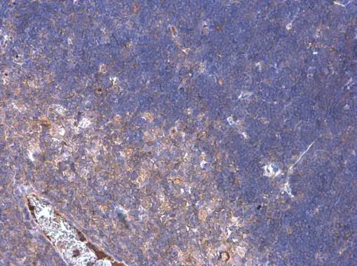 PD1 antibody detects PD1 protein at cell membrane by immunohistochemical analysis. Sample: Paraffin-embedded mouse thymus gland. PD1 stained by PD1 antibody (GTX128435) diluted at 1:500.
 Antigen Retrieval: Citrate buffer, pH 6.0, 15 min