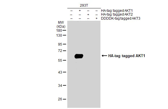 Non-transfected (–) and transfected (+) 293T whole cell extracts (30 μg) were separated by 10% SDS-PAGE, and the membrane was blotted with AKT1 antibody (GTX128456) diluted at 1:5000. The HRP-conjugated anti-rabbit IgG antibody (GTX213110-01) was used to detect the primary antibody.