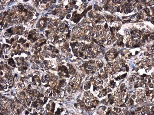 AKT2 antibody