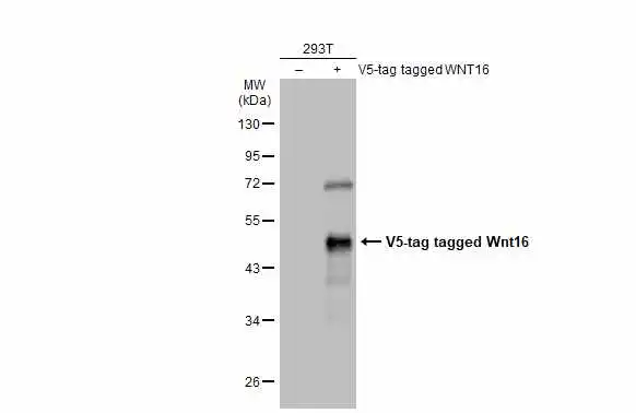 Non-transfected (–) and transfected (+) 293T whole cell extracts (30 μg) were separated by 10% SDS-PAGE, and the membrane was blotted with WNT16 antibody (GTX128468) diluted at 1:5000. The HRP-conjugated anti-rabbit IgG antibody (GTX213110-01) was used to detect the primary antibody. Non-transfected (–) and transfected (+) 293T whole cell extracts (30 μg) were separated by 10% SDS-PAGE, and the membrane was blotted with WNT16 antibody (GTX128468) diluted at 1:5000. The HRP-conjugated anti-rabbit IgG antibody (GTX213110-01) was used to detect the primary antibody.