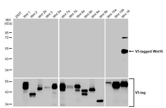 Non-transfected (–) and transfected (+) 293T whole cell extracts (30 μg) were separated by 10% SDS-PAGE, and the membrane was blotted with Wnt16 antibody (GTX128468) diluted at 1:5000. The HRP-conjugated anti-rabbit IgG antibody (GTX213110-01) was used to detect the primary antibody.