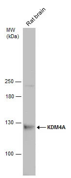 Rat tissue extract (50 μg) was separated by 5% SDS-PAGE, and the membrane was blotted with KDM4A antibody (GTX128497) diluted at 1:500.