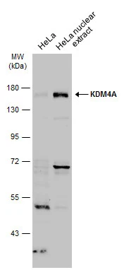 HeLa whole cell and nuclear extracts (30 μg) were separated by 7.5% SDS-PAGE, and the membrane was blotted with KDM4A antibody (GTX128497) diluted at 1:500. The HRP-conjugated anti-rabbit IgG antibody (GTX213110-01) was used to detect the primary antibody. HeLa whole cell and nuclear extracts (30 μg) were separated by 7.5% SDS-PAGE, and the membrane was blotted with KDM4A antibody (GTX128497) diluted at 1:500. The HRP-conjugated anti-rabbit IgG antibody (GTX213110-01) was used to detect the primary antibody.