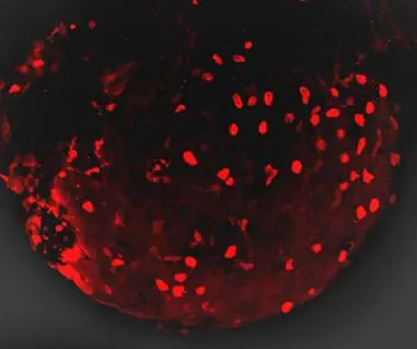 Anti-mCherry antibody (GTX128508) | GeneTex