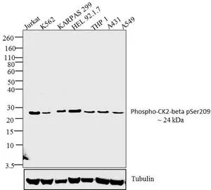 WB analysis of whole cell extract (30ug) of Jurkat (Lane 1),K562 (Lane 2),KARPAS 299 (Lane 3),HEL 92.1.7 (Lane 4),THP1 (Lane 5),A431 (Lane 6) and A549 (Lane 7) using GTX12861 Casein Kinase 2 beta (phospho Ser209) antibody. Dilution : 1:250