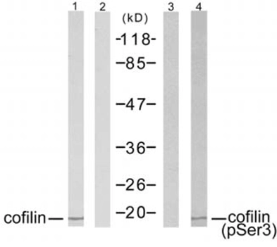 Western blot analysis of extracts from COLO205 cells using cofilin antibody (Lane 1 and 2) and cofilin (phospho-Ser3) antibody (GTX12866,Lane 3 and 4)