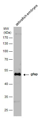 Gfap antibody detects Gfap protein on zebrafish by whole mount immunohistochemical analysis. Sample: 1 day-post-fertilization zebrafish embryo. Gfap antibody (GTX128741) dilution: 1:100. 