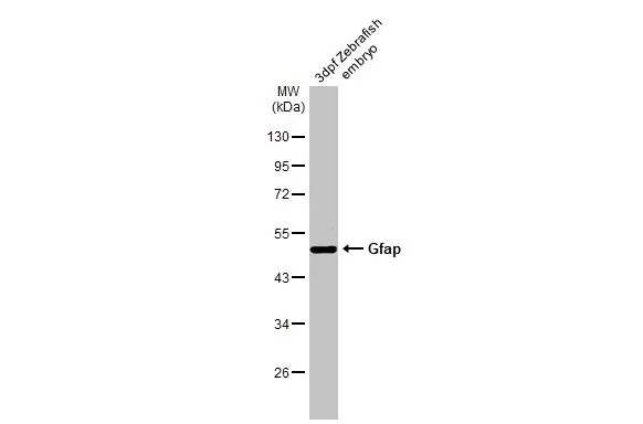 Anti-Gfap antibody (GTX128741) | GeneTex
