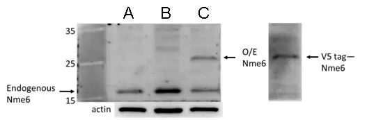 nm23-H6 antibody detects nm23-H6 protein by Western blot analysis. A. 20 μg mouse ESC whole cell lysate/extract B. 50 μg mouse ESC whole cell lysate/extract C. 20 μg whole cell lysate/extract of Nme6-transfected mouse ESC 12 % SDS-PAGE nm23-H6 antibody (GTX128818) dilution: 1:500