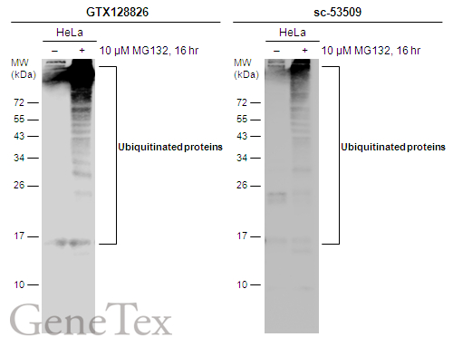 Untreated (–) and treated (+) HeLa whole cell extracts (30 μg) were separated by 12% SDS-PAGE, and the membranes were blotted with Ubiquitin antibody (GTX128826) diluted at 1:500 and competitor's antibody (sc-53509) diluted at 1:500. The HRP-conjugated anti-rabbit IgG antibody (GTX213110-01) was used to detect the primary antibody. *Competitor's antibody is not affiliated with GeneTex and does not endorse this product.