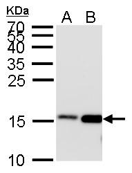Dotblot analysis of anti-Histone H3 (acetyl Lys27) antibody with peptide samples. Varied amount of peptide samples were spotted onto positively charged nylon membrane and blotted with Histone H3 (acetyl Lys27) antibody (GTX128944).