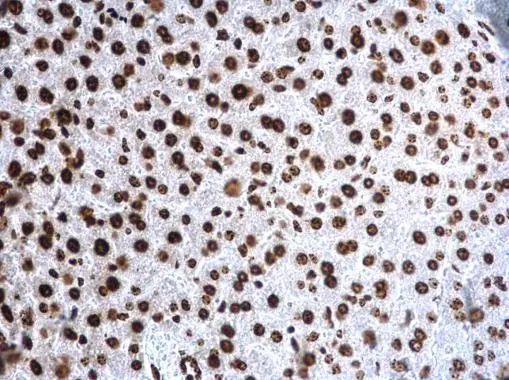 Histone H4K20me3 (trimethyl Lys20) antibody detects Histone H4K20me3 (trimethyl Lys20) protein at nucleus on mouse liver by immunohistochemical analysis. Sample: Paraffin-embedded mouse liver. Histone H4K20me3 (trimethyl Lys20) antibody (GTX128960) dilution: 1:500. 
 Antigen Retrieval: Trilogy? (EDTA based, pH 8.0) buffer, 15min