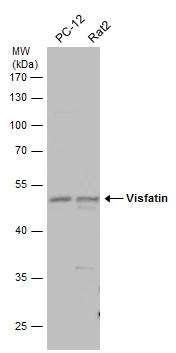Various whole cell extracts (30 μg) were separated by 10% SDS-PAGE, and the membrane was blotted with Visfatin antibody (GTX128980) diluted at 1:500. The HRP-conjugated anti-rabbit IgG antibody (GTX213110-01) was used to detect the primary antibody.
