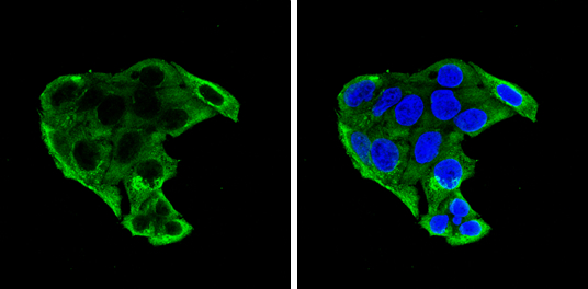 IGFBP1 antibody detects IGFBP1 protein at cytoplasm and Golgi apparatus by immunofluorescent analysis. Sample: HepG2 cells were fixed in 4% paraformaldehyde at RT for 15 min. Green: IGFBP1 stained by IGFBP1 antibody (GTX129006) diluted at 1:500. Blue: Hoechst 33342 staining.