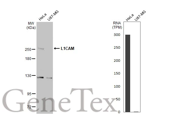 Various whole cell extracts (30 μg) were separated by 5% SDS-PAGE, and the membrane was blotted with L1CAM antibody (GTX129010) diluted at 1:1000. The HRP-conjugated anti-rabbit IgG antibody (GTX213110-01) was used to detect the primary antibody. Corresponding RNA expression data for the same cell lines are based on Human Protein Atlas program.
