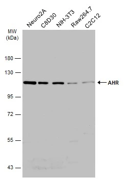 Various whole cell extracts (30 μg) were separated by 7.5% SDS-PAGE, and the membrane was blotted with AHR antibody (GTX129013) diluted at 1:1000. The HRP-conjugated anti-rabbit IgG antibody (GTX213110-01) was used to detect the primary antibody.