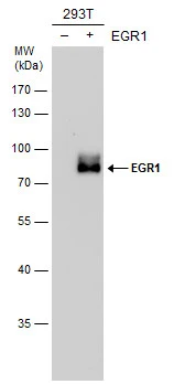 Non-transfected (–) and transfected (+) 293T whole cell extracts (30 μg) were separated by 10% SDS-PAGE, and the membrane was blotted with EGR1 antibody (GTX129015) diluted at 1:5000.
