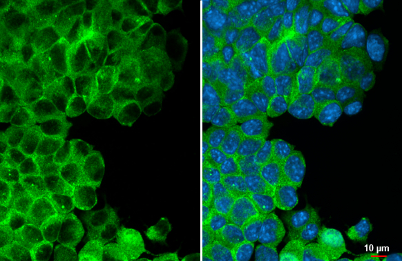 EGR1 antibody detects EGR1 protein at cytoplasm by immunofluorescent analysis. Sample: Neuro2A cells were fixed in 4% paraformaldehyde at RT for 15 min. Green: EGR1 stained by EGR1 antibody (GTX129015) diluted at 1:500. Blue: Fluoroshield with DAPI (GTX30920).