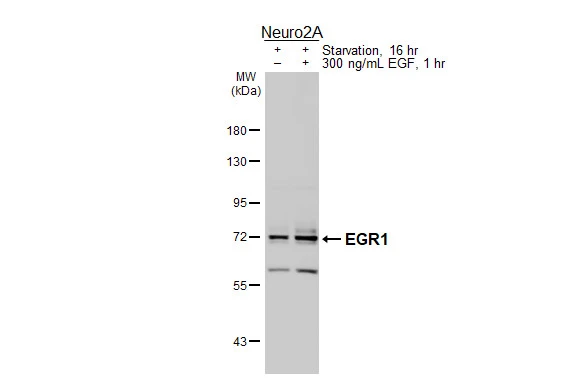 Untreated (–) and treated (+) Neuro2A whole cell extracts (30 μg) were separated by 7.5% SDS-PAGE, and the membrane was blotted with EGR1 antibody (GTX129015) diluted at 1:1000. The HRP-conjugated anti-rabbit IgG antibody (GTX213110-01) was used to detect the primary antibody.