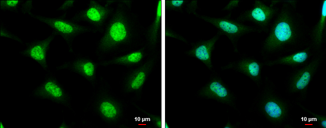 SP2 antibody detects SP2 protein at cytoplasm and nucleus by immunofluorescent analysis. Sample: HeLa cells were fixed in 4% paraformaldehyde at RT for 15 min. Green: SP2 stained by SP2 antibody (GTX129030) diluted at 1:1000. Blue: Hoechst 33342 staining. Scale bar= 10μm.