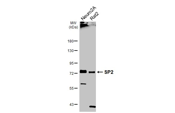 Various whole cell extracts (30 μg) were separated by 7.5% SDS-PAGE, and the membrane was blotted with SP2 antibody (GTX129030) diluted at 1:1000. The HRP-conjugated anti-rabbit IgG antibody (GTX213110-01) was used to detect the primary antibody.
