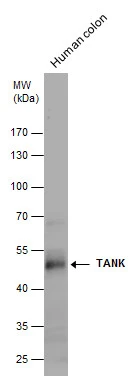 TANK antibody detects TANK protein by western blot analysis. Human tissue extracts (30 μg) was separated by 10% SDS-PAGE, and the membrane was blotted with TANK antibody (GTX129037) diluted at 1:1000.