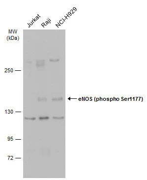 Untreated (�) and treated (+) THP-1 whole cell extracts (30 ug) were separated by 5% SDS-PAGE,and the membrane was blotted with eNOS (phospho Ser1177) antibody (GTX129058) diluted at 1:500.