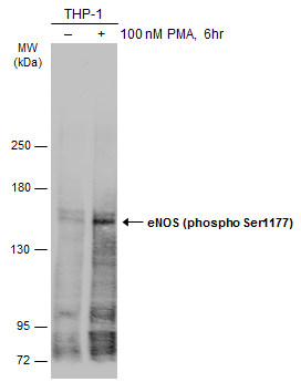 Untreated (�) and treated (+) THP-1 whole cell extracts (30 ug) were separated by 5% SDS-PAGE,and the membrane was blotted with eNOS (phospho Ser1177) antibody (GTX129058) diluted at 1:500.