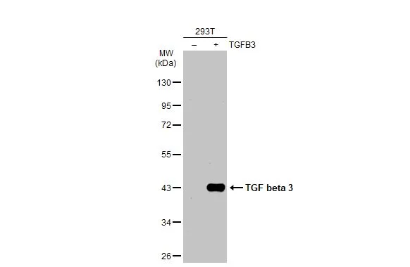 Non-transfected (–) and transfected (+) 293T whole cell extracts (30 μg) were separated by 10% SDS-PAGE, and the membrane was blotted with TGF beta 3 antibody (GTX129091) diluted at 1:20000. The HRP-conjugated anti-rabbit IgG antibody (GTX213110-01) was used to detect the primary antibody.